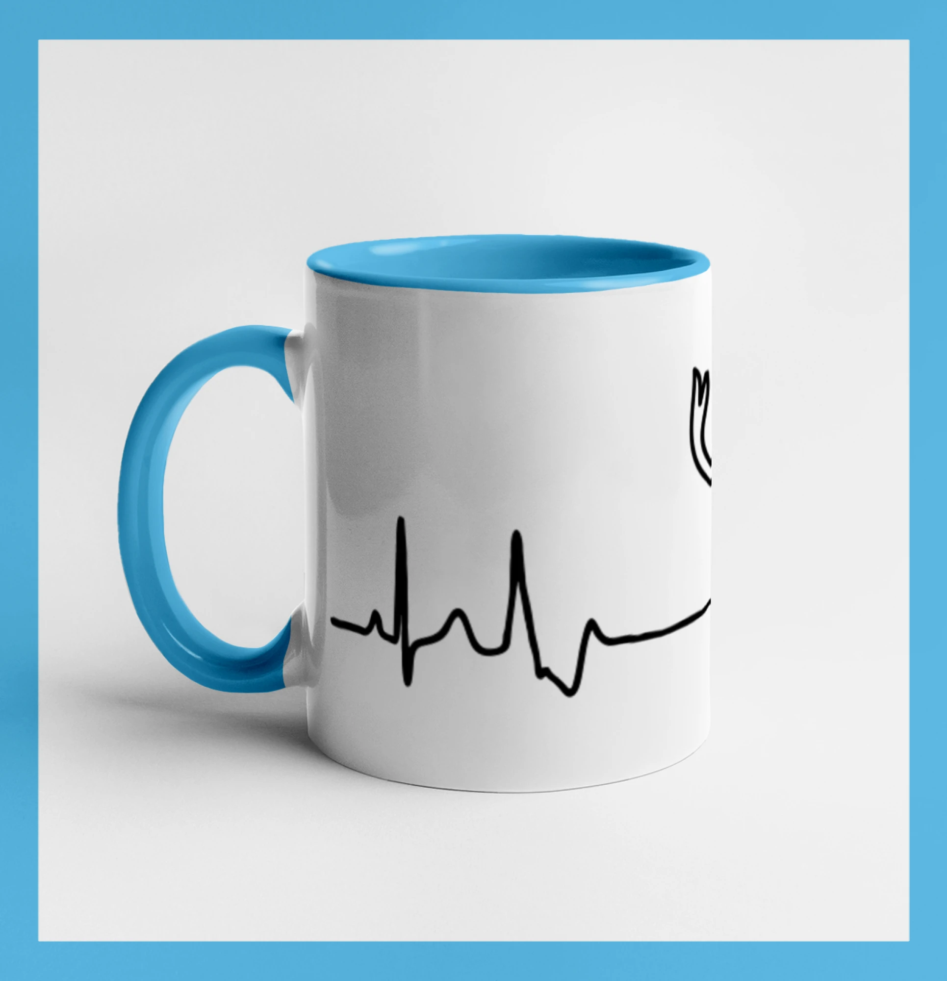Jelen EKG