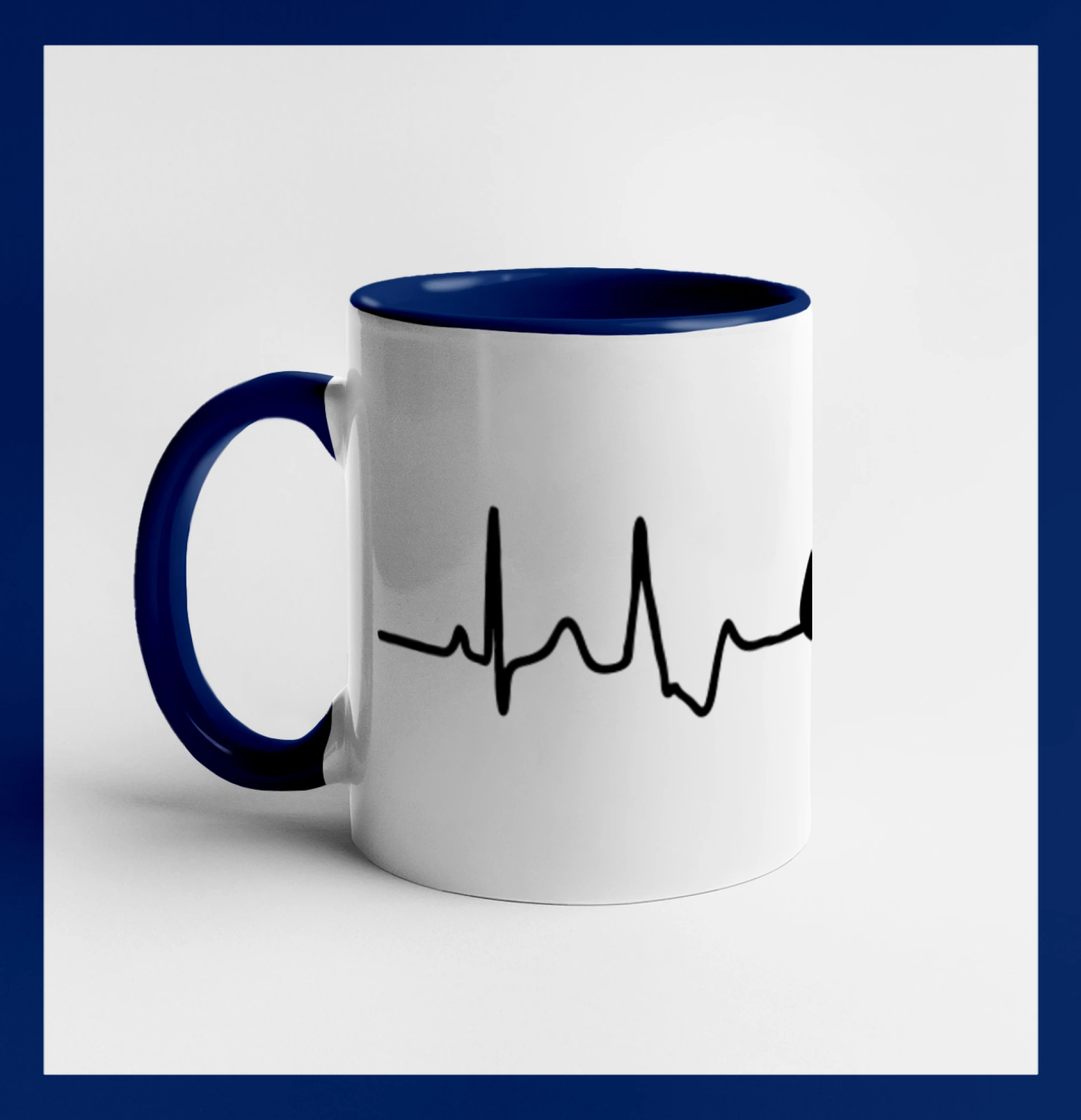 Ekg rugby