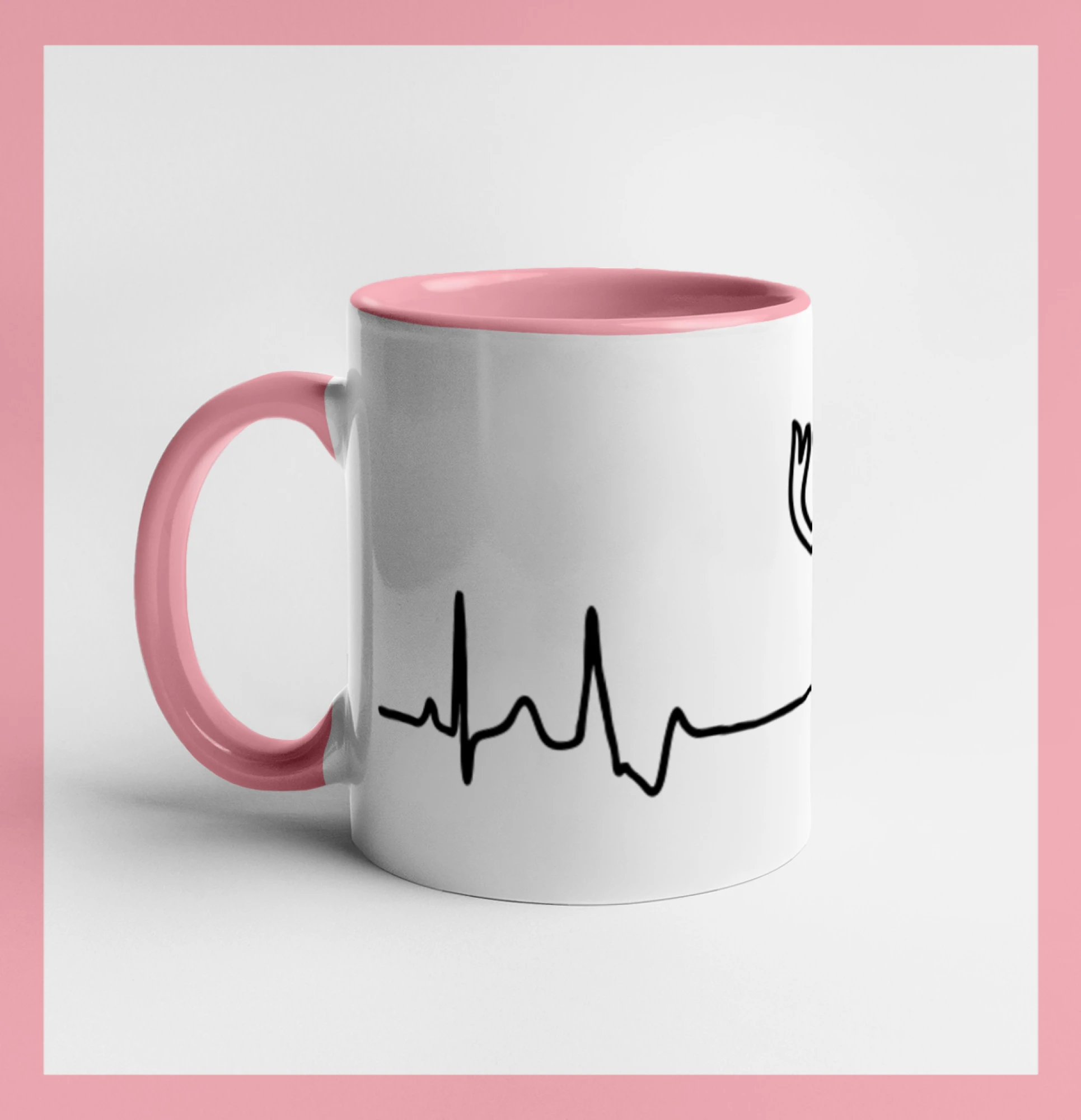 Jelen EKG
