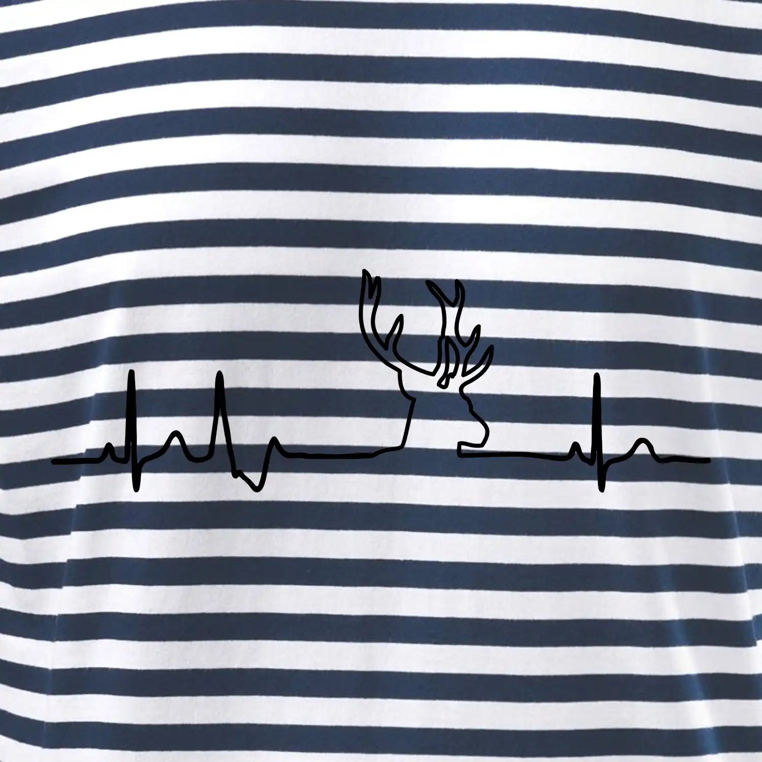 Jelen EKG