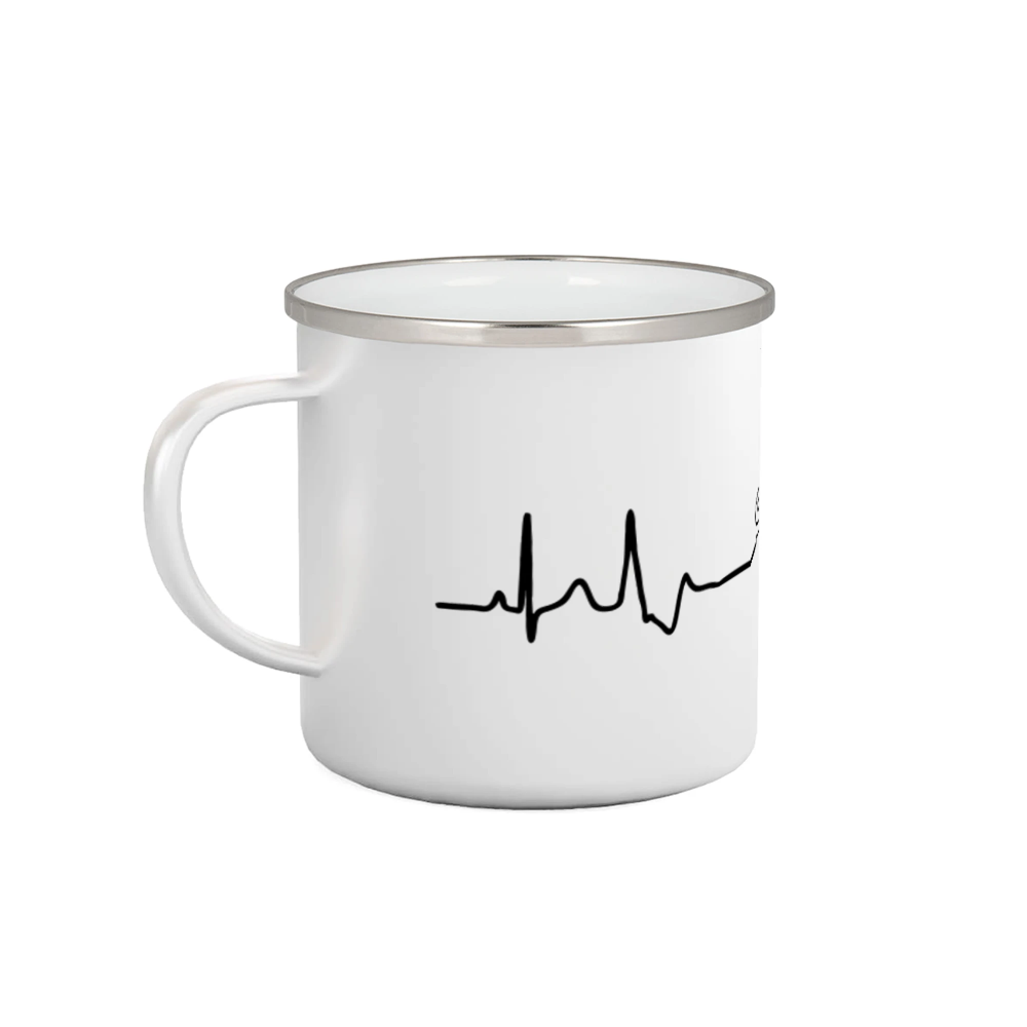 SDH EKG